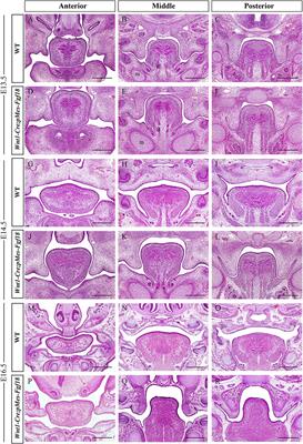 Overexpression of Fgf18 in cranial neural crest cells recapitulates Pierre Robin sequence in mice